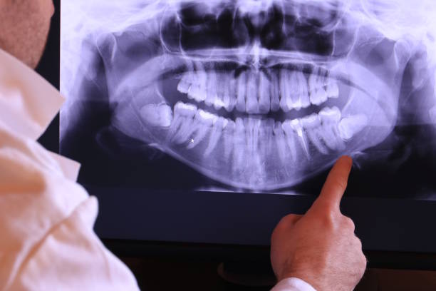 Best Emergency Treatment for Oral Infections in Emmett, ID